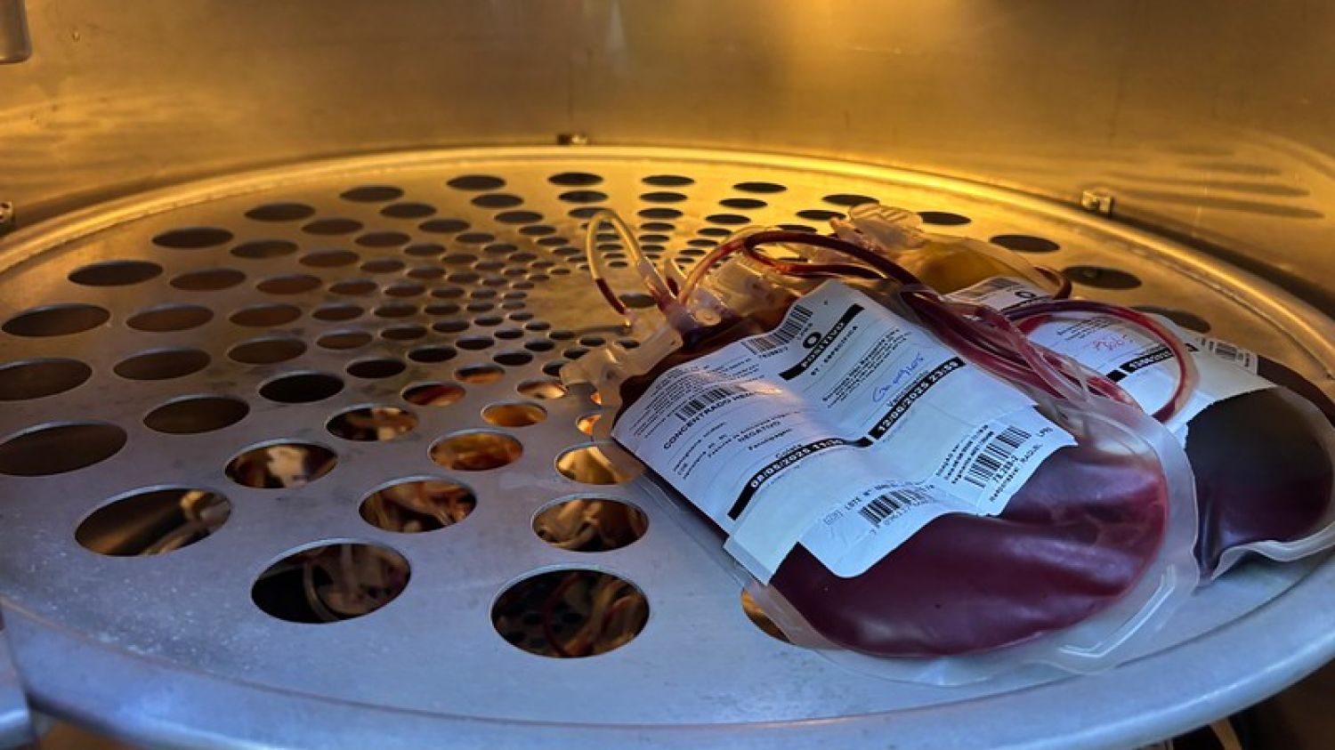 Americana: Banco de Sangue do Hospital Municipal necessita de doadores